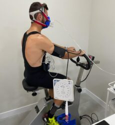 Cardiologista faz alerta sobre arritmia e a prática esportiva