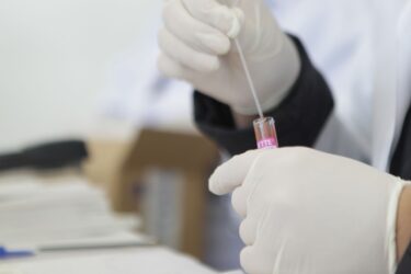 Prevenção: Saúde de Suzano detecta 24 casos de ISTs após 1.538 testes na campanha “Fique Sabendo!”