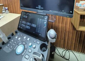 Santa Casa de Mogi implanta ultrassom com inteligência artificial  para aprimorar diagnósticos