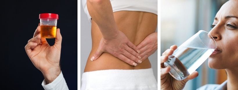 Calor intenso faz casos de pedra nos rins crescerem até 30% no verão, aponta levantamento