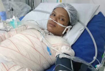 Jeniffer segue internada após queimaduras em baile Abre-Alas do CCMC e família pede ajuda financeira