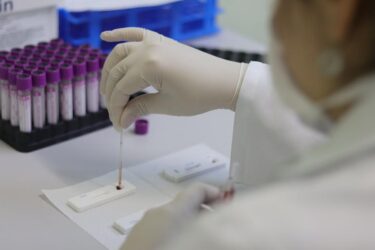 Unidades de Saúde da Família de Suzano promovem ações de prevenção às hepatites virais